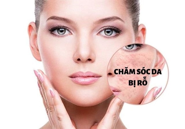 Cách chăm sóc da mặt bị rỗ 